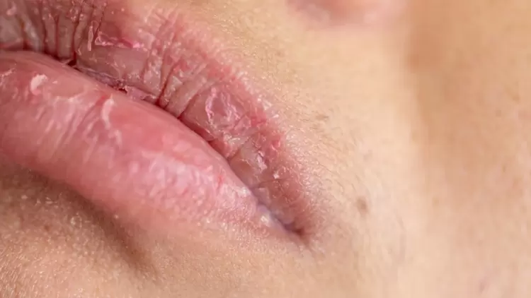 I feel my mouth getting dry